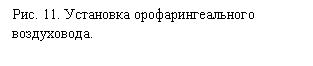Подпись: