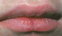 http://*****/img/2101-5.jpg