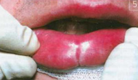 http://*****/img/2101-7.jpg