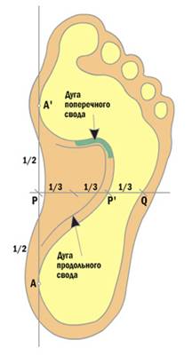 Виды плоскостопия