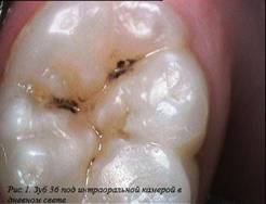 http://www.lechimzubki.net/edimg/image/sopro1.jpg