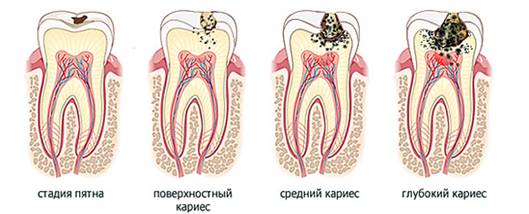 http://*****/assets/images/lechenie_kariesa_price.jpg