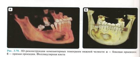 D:\Эля\Документы\ГХС\Эльчук\Фолликул киста (1).jpg